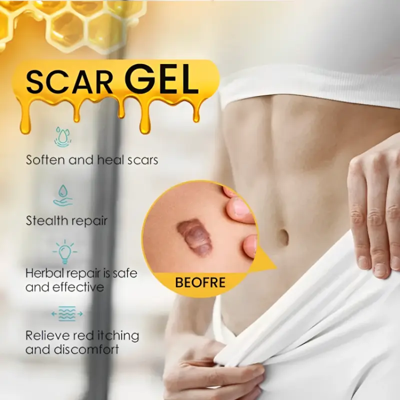 جل علاج الندبات وإزالة علامات التمدد - الصورة 2