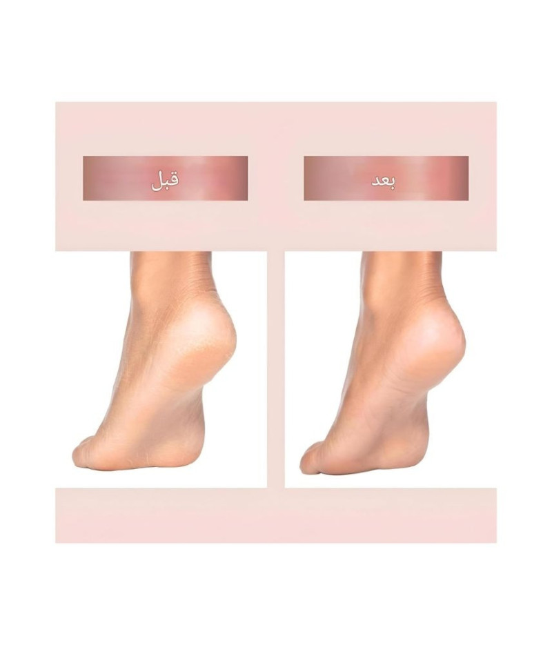 عرض قطعتين من أداة باديكير كهربائية قابلة لإعادة الشحن لإزالة الجلد الميت - الصورة 4