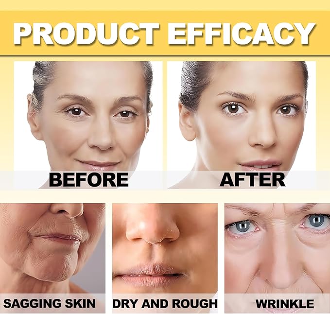 botox bee venom Cream عرض قطعتين - الصورة 3